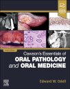 Cawson's Essentials of Oral Pathology and Oral Medicine