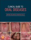 Clinical Guide to Oral Diseases