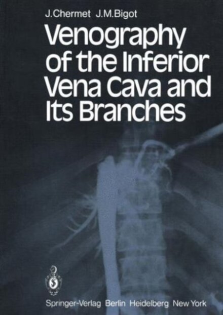 Venography of the Inferior Vena Cava and Its Branches