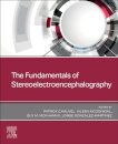 The Fundamentals of Stereoelectroencephalography