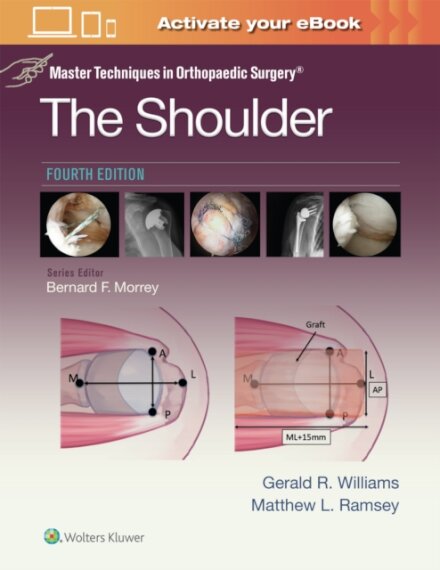 Master Techniques in Orthopaedic Surgery: The Shoulder: Print + eBook with Multimedia