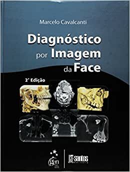 Diagnóstico Por Imagem Da Face