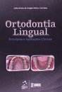 Ortodontia Lingual Princípios E Aplicações Clínicas