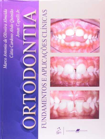 Ortodontia Fundamentos E Aplicações Clínicas