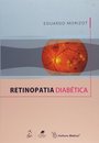 Retinopatia Diabética