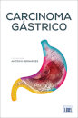 Carcinoma Gástrico