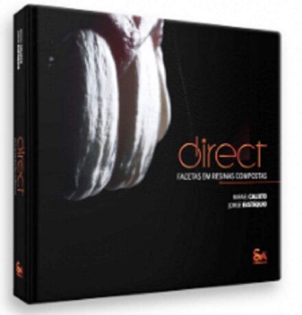 Direct Facetas Em Resinas Compostas