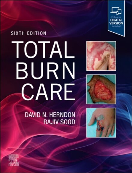 Total Burn Care