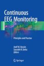 Continuous EEG Monitoring
