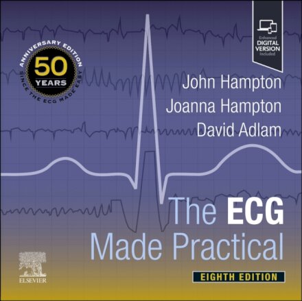 The ECG Made Practical