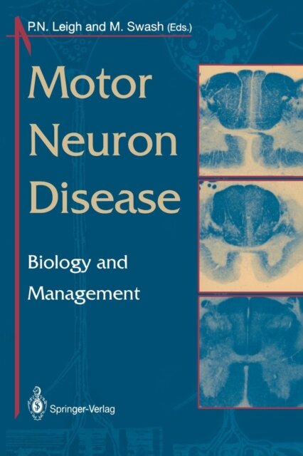 Motor Neuron Disease