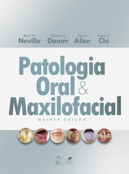 Patologia Oral e Maxilofacial 5/25