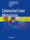 Colorectal Liver Metastasis
