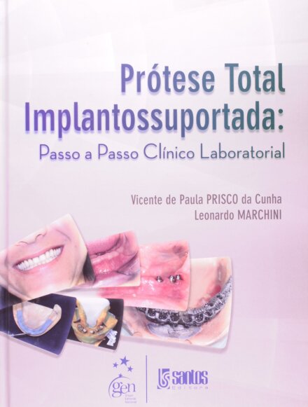 Prótese Total Implantossuportada Passo a Passo - Clínico e Laboratorial