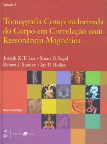 Tomografia Computadorizada Corpo Correlação Com Rm 2V