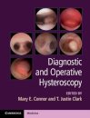 Diagnostic and Operative Hysteroscopy