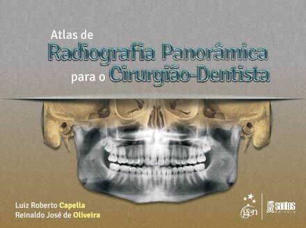 Atlas De Radiografia Panorâmica Para Cirurgião-Dentista