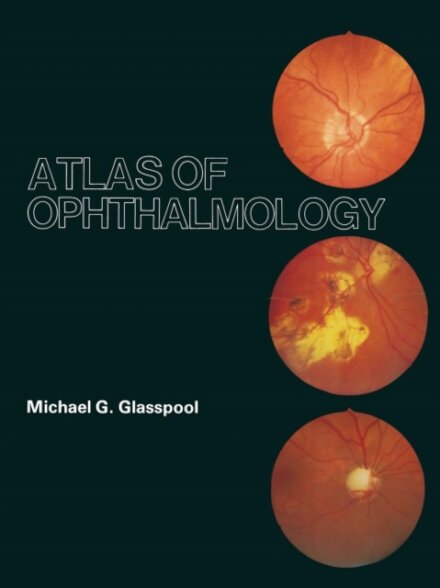 Atlas of Ophthalmology