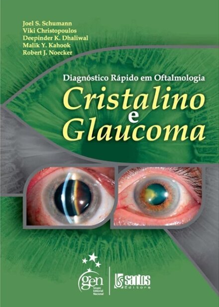 Diagnóstico Rápido Oftalmologia Cristalino E Glaucoma