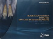 Reabilitação Estética Dentes Tratados Endodonticamente - Pinos de Fibra Possibilidades Clínicas Conservadoras
