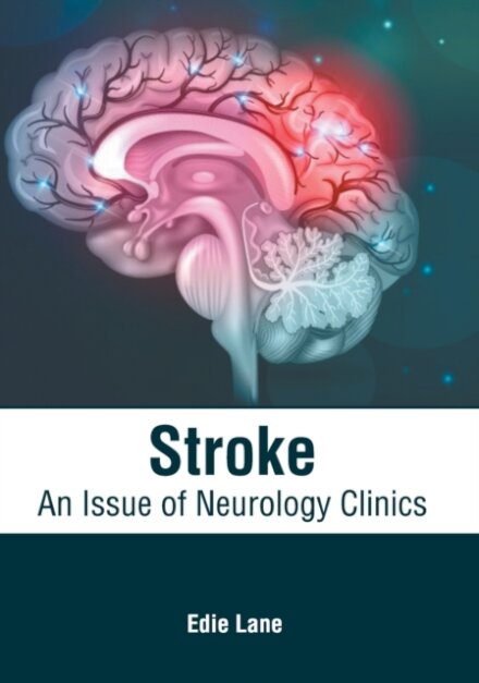 Stroke: An Issue of Neurology Clinics