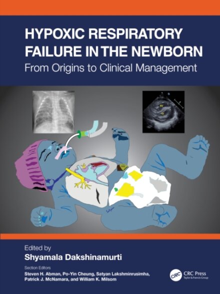 Hypoxic Respiratory Failure in the Newborn