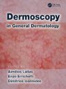 Dermoscopy in General Dermatology