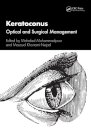 Keratoconus