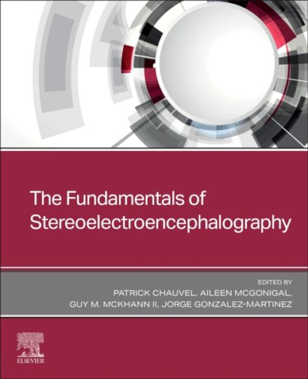 The Fundamentals of Stereoelectroencephalography