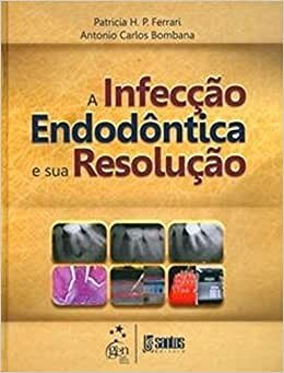 A Infecção Endodôntica E Sua Resolução