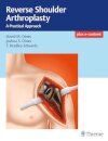 Reverse Shoulder Arthroplaty-Pratical Approach