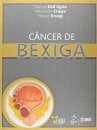 Câncer De Bexiga