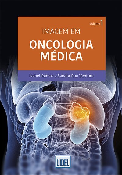Imagem em Oncologia Médica - Volume I