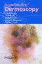 Handbook of Dermoscopy