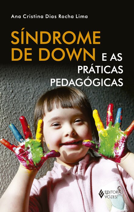 Síndrome De Down E As Práticas Pedagógicas