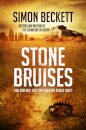 Stone Bruises