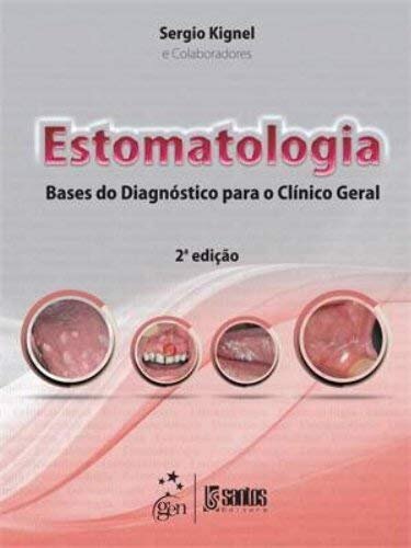 Estomatologia Bases Do Diagnóstico Para Clínico Geral