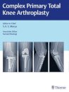 Complex Primary Total Knee Arthroplasty