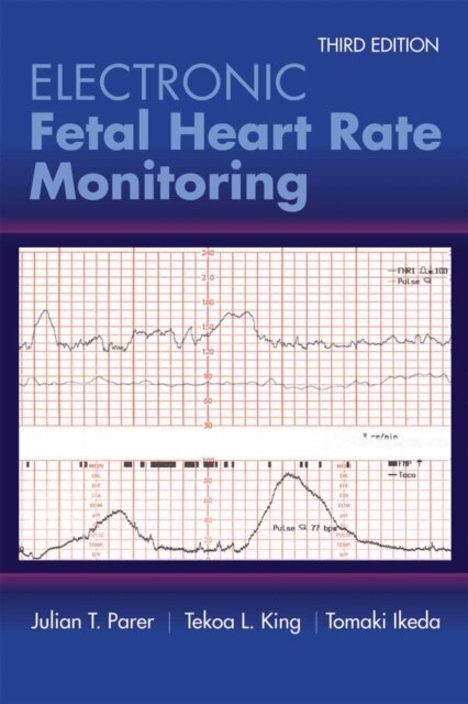 Electronic Fetal Heart Rate Monitoring: the 5-Tier System