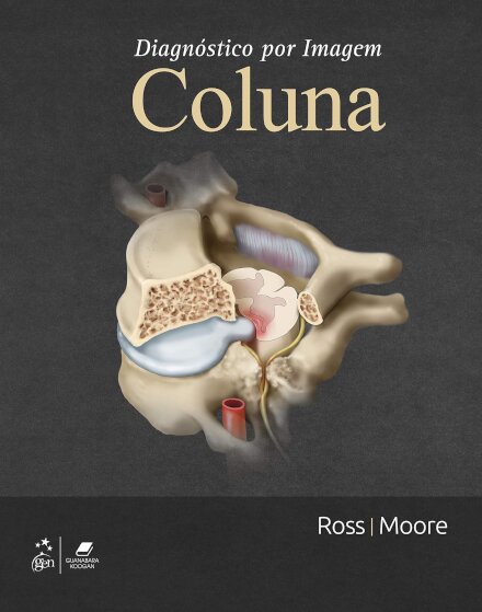 Diagnóstico Por Imagem Coluna