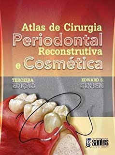 Atlas De Cirurgia Periodontal Reconstrutiva E Cosmética