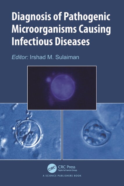 Diagnosis of Pathogenic Microorganisms Causing Infectious Diseases