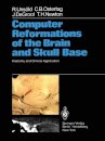 Computer Reformations of the Brain and Skull Base