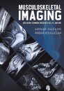 Musculoskeletal Imaging