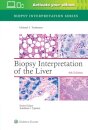 Biopsy Interpretation of the Liver
