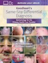 Goodheart's Same-Site Differential Diagnosis