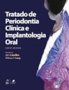 Tratado De Periodontia Clínica E Implantologia Oral