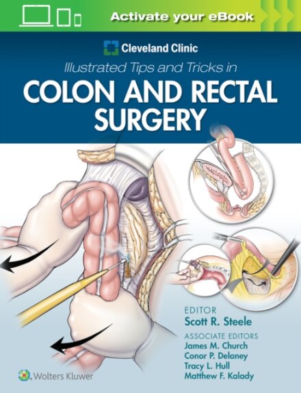 Cleveland Clinic Illustrated Tips and Tricks in Colon and Rectal Surgery