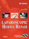 Laparoscopic Hernia Repair