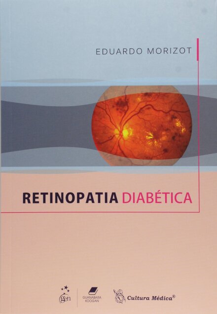 Retinopatia Diabética